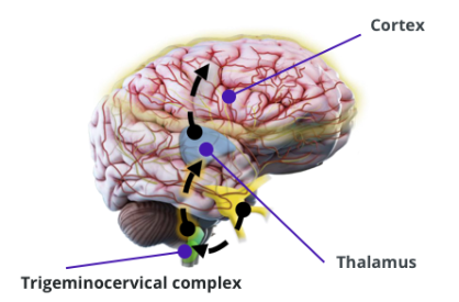 Pathophysiology of Migraine | Science of Migraine