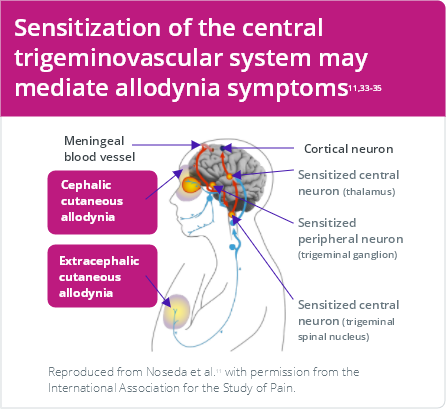 Ijms Free Full Text Migraine Pathophysiology Revisited Proposal Of